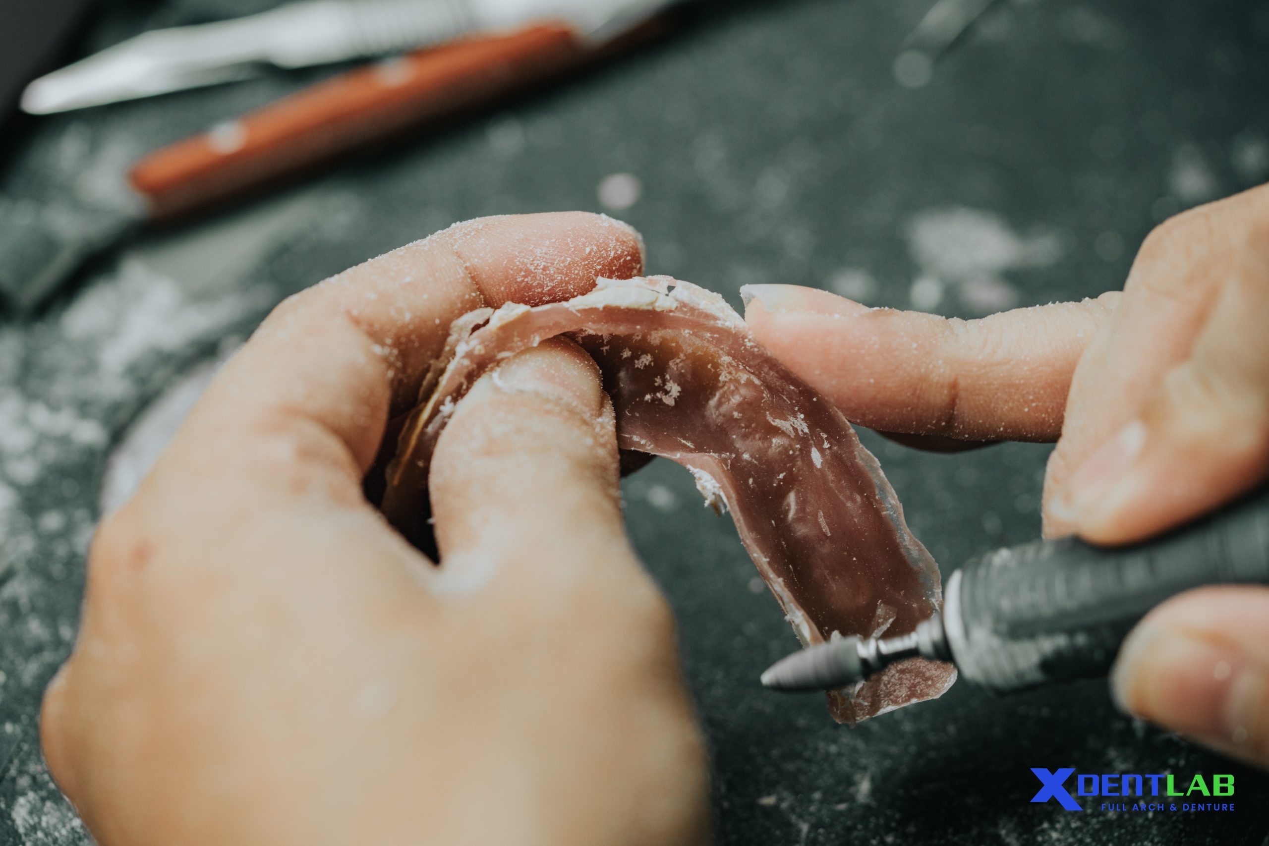 XDENT LAB – Built for Full Arch & Implant Outsourcing