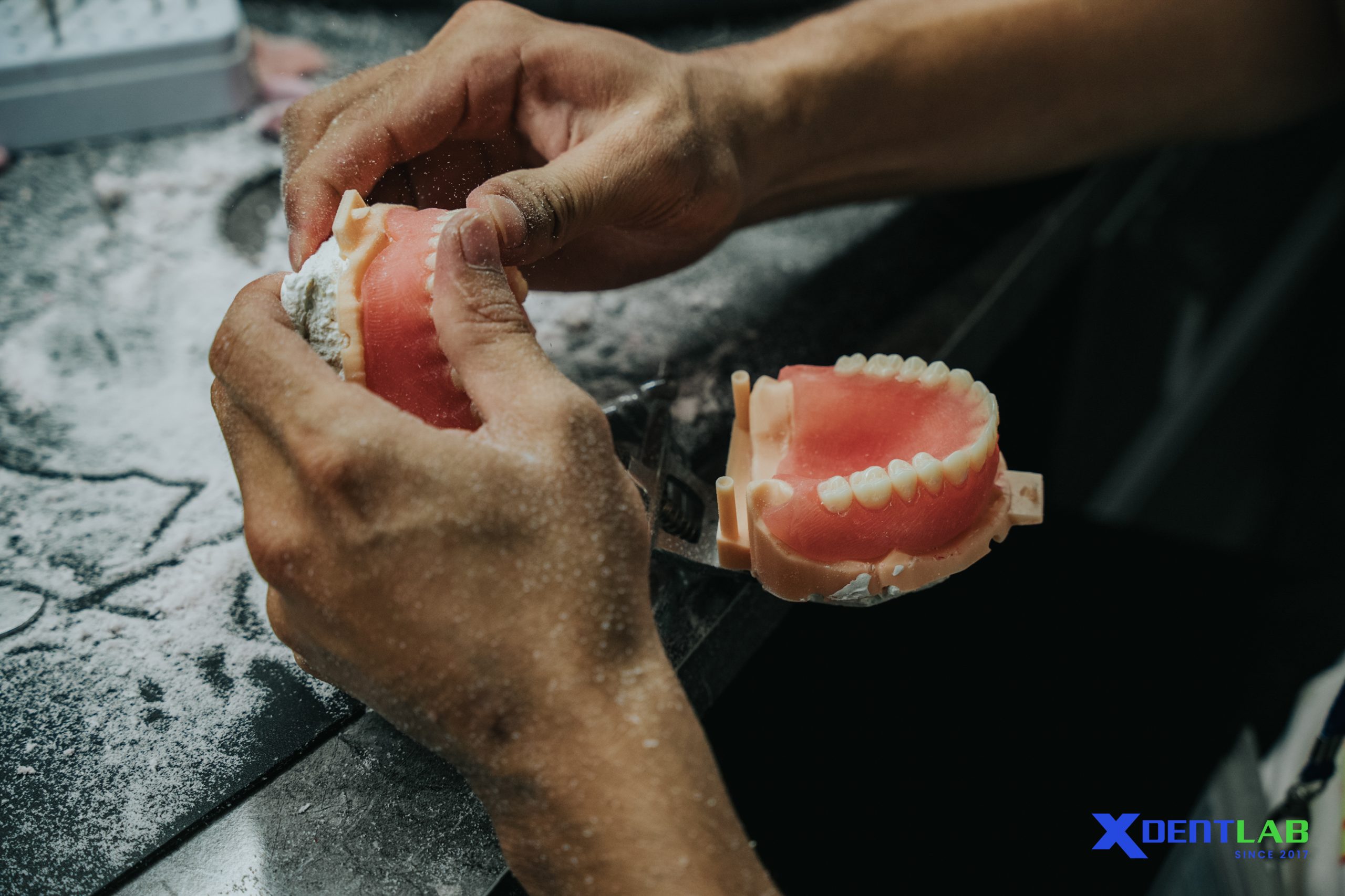 Full Arch & Implant Outsourcing Services – Vietnam’s XDENT LAB for U.S. Dental Labs
