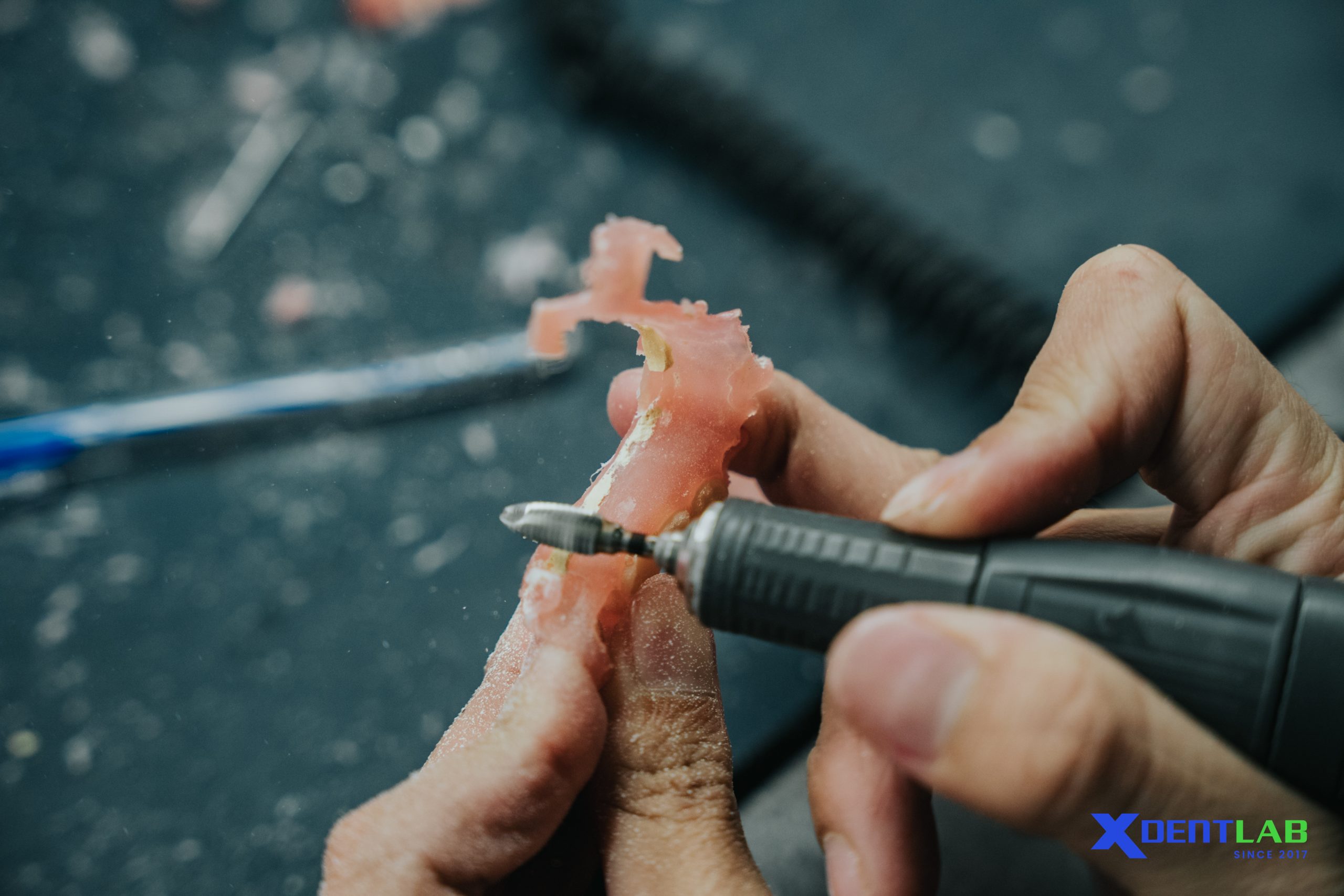 Is Full Arch & Implant Outsourcing Right for Your Lab?
