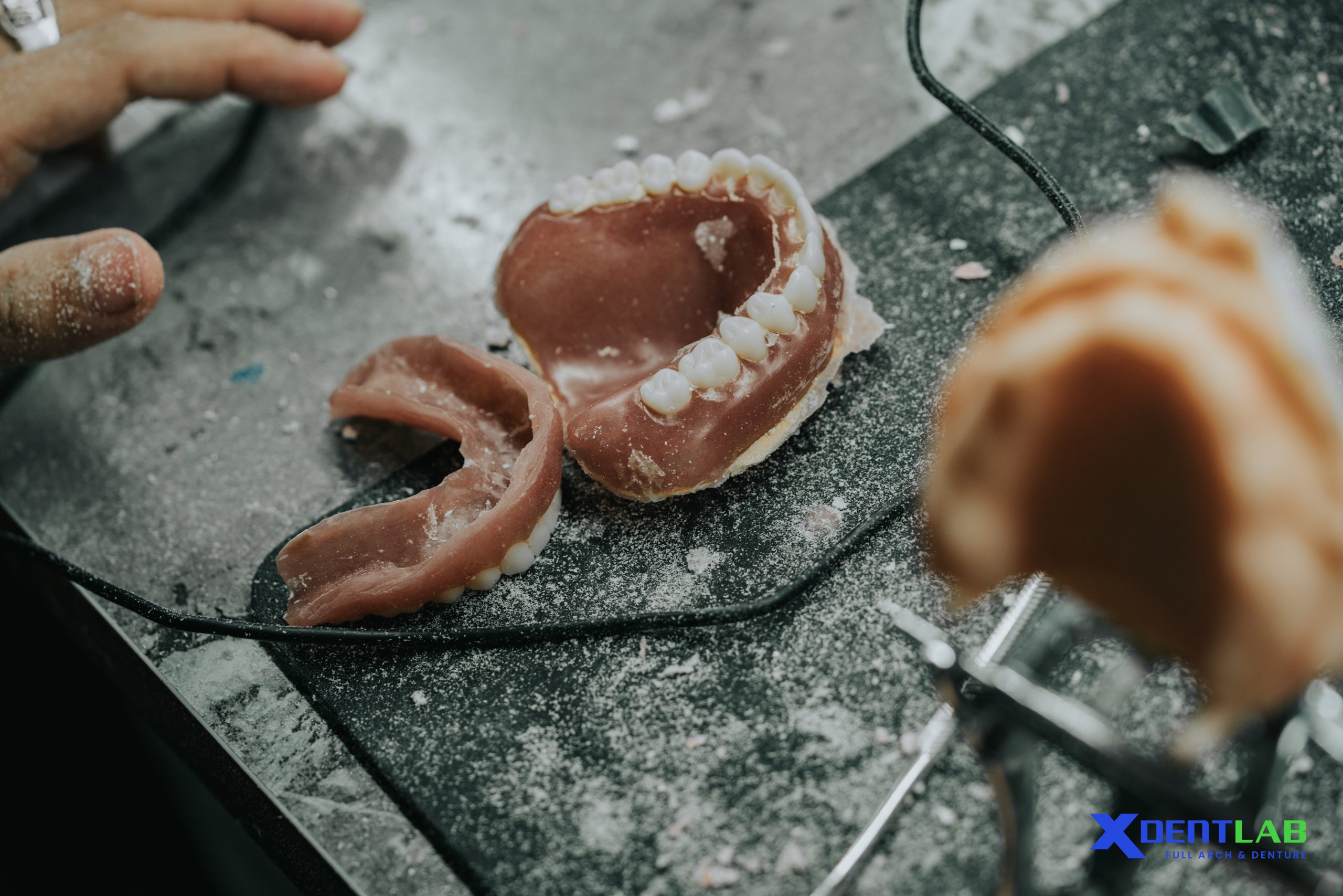 Risks to Be Aware of When Outsourcing Dental Work